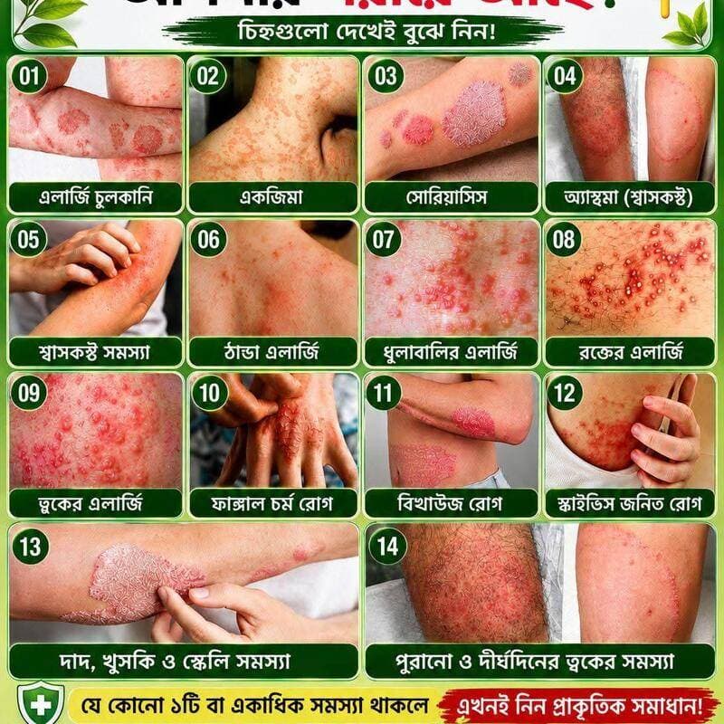 এলার্জি বিনাশ  ১ মাসের কোর্স thumbnail 2
