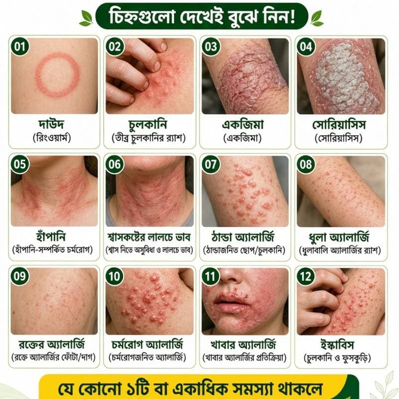 এলার্জি বিনাশ  ১ মাসের কোর্স thumbnail 3